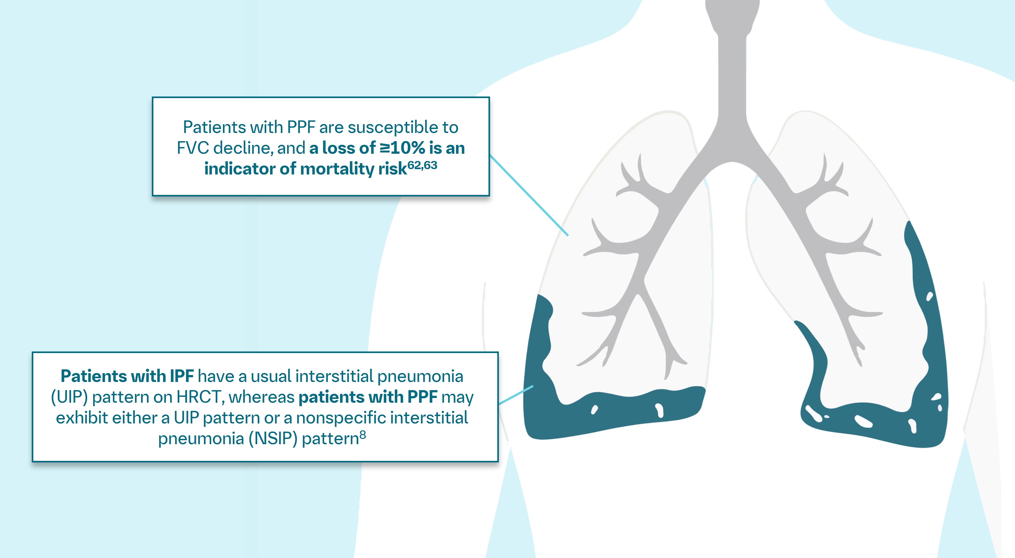 Understanding Pulmonary Fibrosis | IPF and PPF