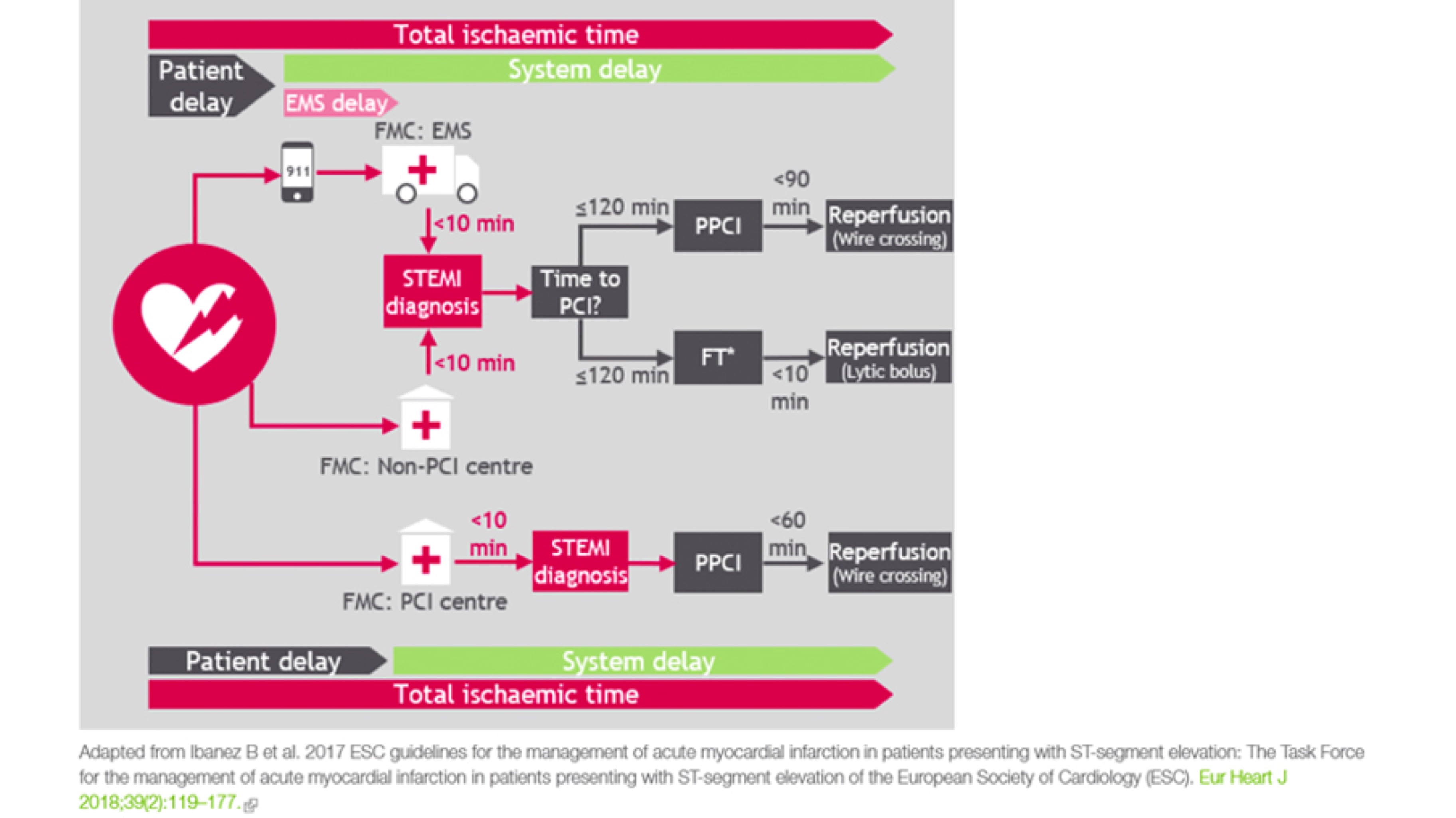 STEMI Networks