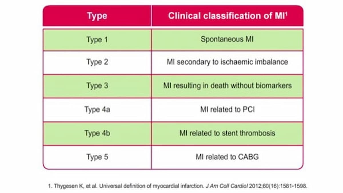 Classification of MI