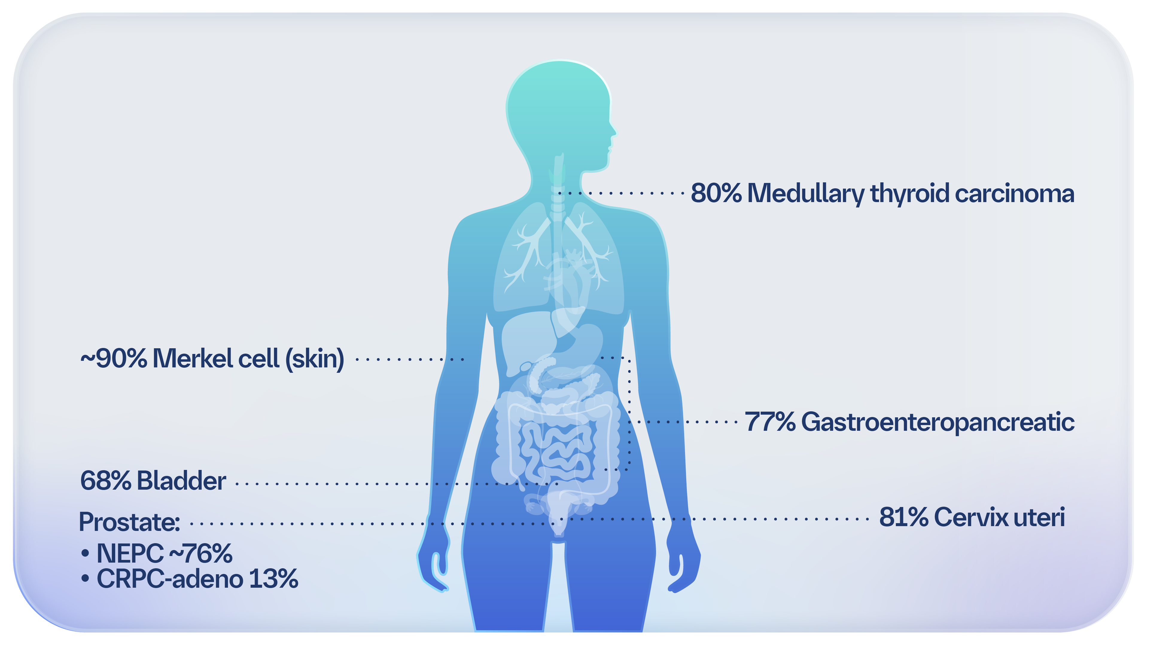 DLL3 Biomarker in epNEC: Predictive Potential & Clinical Insights