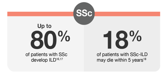 Up to 80% of patients with SSc develop ILD. 18% of
				patients with SSc-ILD may die within 5 years