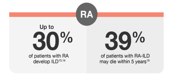 Up to 30% of patients with RA develop ILD. 39% of
				patients with RA-ILD may die within 5 years