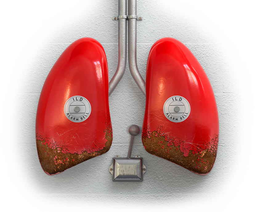 lung-shaped fire alarms with ILD