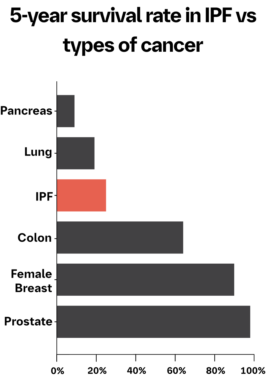 Interstitial Lung Disease Life Expectancy