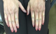 CTD Hands Example