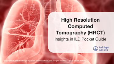 High Resolution Computed Tomography (HRCT) Pocket Guide