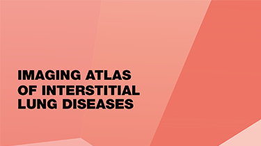 Imaging Atlas of Interstitial Lung Diseases