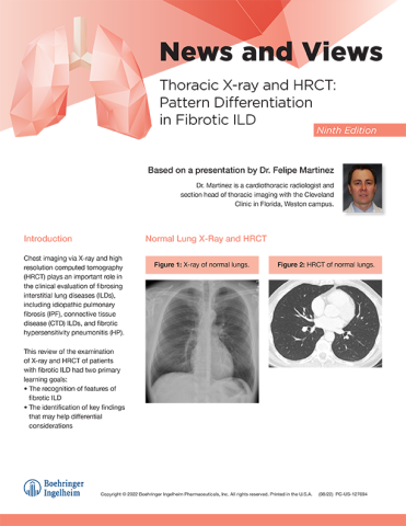 Thoracic X-ray and HRCT: Pattern Differentiation in Fibrotic ILD