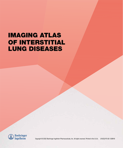 Imaging Atlas of Interstitial Lung Diseases