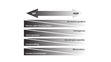 uip nsip difference diagram