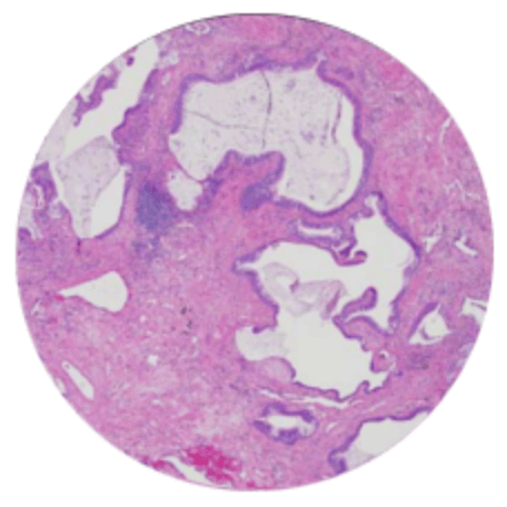 Low magnification pathology image