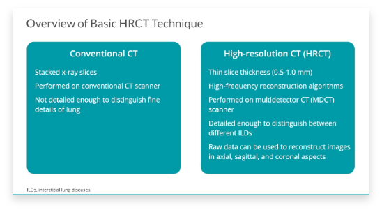 Watch the overview of basic HRCT technique video