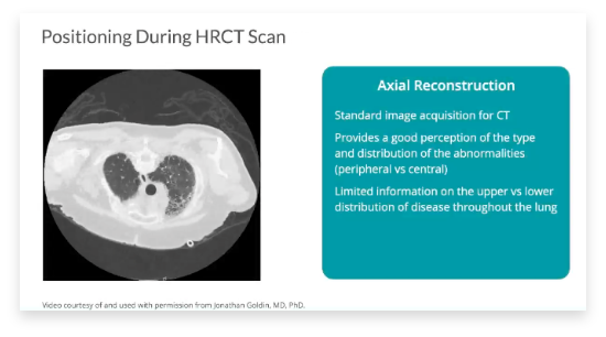 Watch the axial reconstruction video