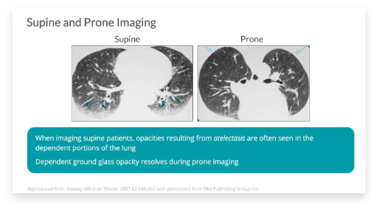 Watch the supine and prone imaging video