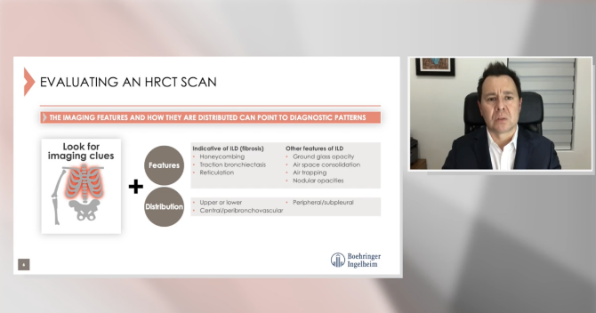 Watch the HRCT vs X-ray comparison video